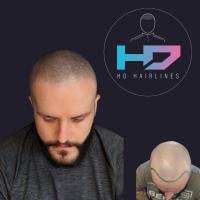 HD Hairlines image 3
